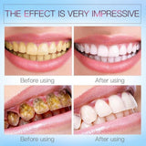 Maxbell Maxbell 1 Pcs Teeth Whitening Pen Whitener Cleaning Bleaching Stains Remover