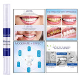 Maxbell Maxbell 1 Pcs Teeth Whitening Pen Whitener Cleaning Bleaching Stains Remover