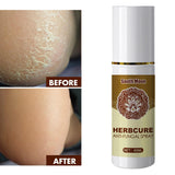 Maxbell 3x Foot Spray Anti-Fungal Infection Beriberi Spray Damaged Skin Moisturizer