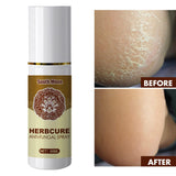 Maxbell 3x Foot Spray Anti-Fungal Infection Beriberi Spray Damaged Skin Moisturizer