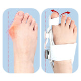 Maxbell Bunion Big Toe Corrector Hammer Toe Correction Wear Improves Toe Realignment