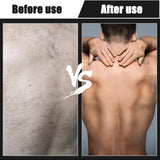 Maxbell Back Hair Shaver Easy to Use DIY Back Hair Trimmer for Personal Birthday Man Blue