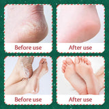 Maxbell 3Pcs Foot Mask Thanksgiving Christmas Gift for Dry Foot Foot SPA Exfoliating