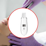 Maxbell Facial Scrubber USB Rechargeable Skin Scrubber for Make up Holidays New Year