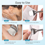 Maxbell Pore Prep Tool Blackhead Removers Pimple Tool Kit for Comedone Blemish Gifts