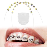 Maxbell 2x Temporary Tooth Decoration Brace Accessory Brace Chain Ligature Ties Yellow