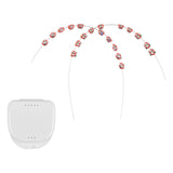 Maxbell 2x Temporary Tooth Decoration Brace Accessory Brace Chain Ligature Ties Red