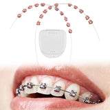 Maxbell 2x Temporary Tooth Decoration Brace Accessory Brace Chain Ligature Ties Red