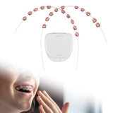 Maxbell 2x Temporary Tooth Decoration Brace Accessory Brace Chain Ligature Ties Red