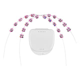 Maxbell 2x Temporary Tooth Decoration Brace Accessory Brace Chain Ligature Ties Pink