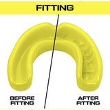 Maxbell Sports Mouth Guard Men Women Protection for Basketball Mma Boxing Kickboxing Yellow