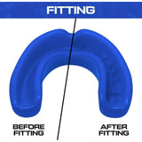 Maxbell Sports Mouth Guard Men Women Protection for Basketball Mma Boxing Kickboxing Blue
