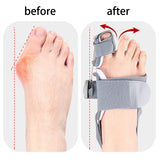 Maxbell Bunion Toe Straightener Realign Toes  Comfortable Bunion Corrector