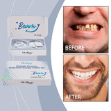 Maxbell Full Denture Fix Confident Smile Comfortable Wear Temporary Teeth for Adults