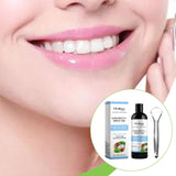 Maxbell 100ml Mouthwash Sturdy Dorm Teeth Cleaning Brightening Easy to Use Accessory