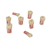 Dentistry Exam Open Pulp Root Canal Model in Vitro Dental Pulp Cavity 0.4×0.4×1.6 inches