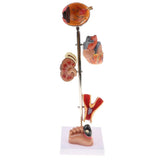 Maxbell Removable 5 Parts Pathological Diabetes 5 Parts (Eye ball, Heart, ney, Vessel, Foot) Model School Teaching Display - Aladdin Shoppers