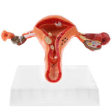Maxbell Maxbell 1:1 Human Female Uterus Ovary Pathological +Normal Model Anatomical Study