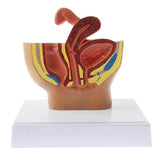 Maxbell Maxbell 1:2 Sagittal Section Of Human Female Pelvis Cavity Organs of Generation Structure Model Biological Learning Display