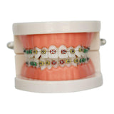 Maxbell Sumulation Teeth Model with Metal Brace for Teacher Classroom Kids Teaching