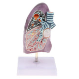 Maxbell Maxbell 2:3 Human Diseased Lung Structure Respiratory System Pathological Model Kits Lab Supplies School Teaching Display