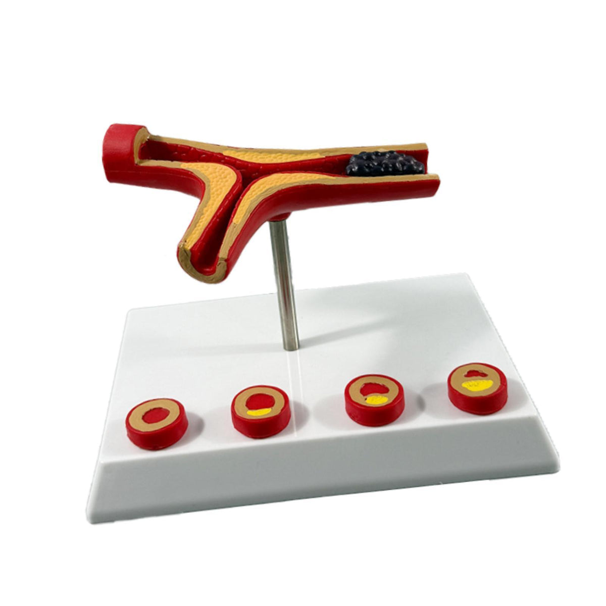 Maxbell Human Vessel Model Realistic Cardiovascular Model for Learning Classroom Lab