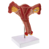 Maxbell Maxbell 1:1 Human Female Uterus Ovary Pathological +Normal Model Anatomical Study