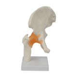 Maxbell Ligament Hip Joint Model Sturdy Teaching Aids for Office School Bone Doctors
