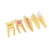 Maxbell Maxbell 12x Enlarged Anatomical Human Teeth Tooth Model, Set of 3 Different Models