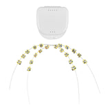 Maxbell 2x Temporary Tooth Decoration Brace Accessory Brace Chain Ligature Ties Yellow