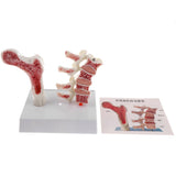 1:1 Human Lumbar Vertebra Thighbone Osteoporosis Pathology Model Kits School Teaching Display - Aladdin Shoppers