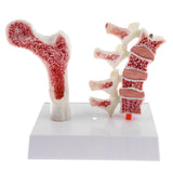 1:1 Human Lumbar Vertebra Thighbone Osteoporosis Pathology Model Kits School Teaching Display - Aladdin Shoppers
