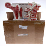 1:1 Human Lumbar Vertebra Thighbone Osteoporosis Pathology Model Kits School Teaching Display - Aladdin Shoppers