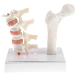 1:1 Human Lumbar Vertebra Thighbone Osteoporosis Pathology Model Kits School Teaching Display - Aladdin Shoppers