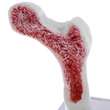 1:1 Human Lumbar Vertebra Thighbone Osteoporosis Pathology Model Kits School Teaching Display - Aladdin Shoppers