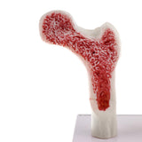 1:1 Human Lumbar Vertebra Thighbone Osteoporosis Pathology Model Kits School Teaching Display - Aladdin Shoppers