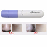 Maxbell Portable Handheld Electric Facial Skin Cleansing Makeup Pore Cleansing Cleaner Blackhead Zit Acne Suction Remover Tool Deep Clean