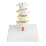 Maxbell 1:1 Human 4 Lumbar Vertebrae Intervertebral Disc Skeleton Model School Teaching Display Lab Supplies