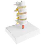 Maxbell 1:1 Human 4 Lumbar Vertebrae Intervertebral Disc Skeleton Model School Teaching Display Lab Supplies