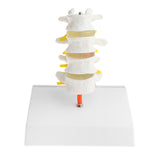 Maxbell 1:1 Human 4 Lumbar Vertebrae Intervertebral Disc Skeleton Model School Teaching Display Lab Supplies