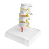 Maxbell 1:1 Human 4 Lumbar Vertebrae Intervertebral Disc Skeleton Model School Teaching Display Lab Supplies