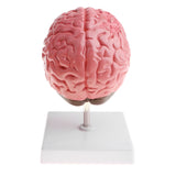 Maxbell Minification 1X Human Brain Brainstem Cerebral Hemorrhage Diseased Pathological Model Teaching Model