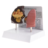 Maxbell Minify 1x Human Lung Normal & Pathological Comparison Lab Demonstration Model Kits Learning Resources