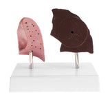 Maxbell Minify 1x Human Lung Normal & Pathological Comparison Lab Demonstration Model Kits Learning Resources