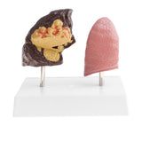 Maxbell Minify 1x Human Lung Normal & Pathological Comparison Lab Demonstration Model Kits Learning Resources