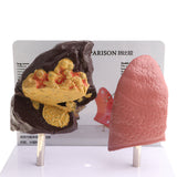 Maxbell Minify 1x Human Lung Normal & Pathological Comparison Lab Demonstration Model Kits Learning Resources