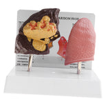 Maxbell Minify 1x Human Lung Normal & Pathological Comparison Lab Demonstration Model Kits Learning Resources