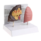 Maxbell Minify 1x Human Lung Normal & Pathological Comparison Lab Demonstration Model Kits Learning Resources