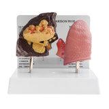 Maxbell Minify 1x Human Lung Normal & Pathological Comparison Lab Demonstration Model Kits Learning Resources