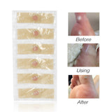 Maxbell Toes Pads Corrector/Straightener for Curled - Corns, Calluses Remover - Gel Support Cushion 42pcs